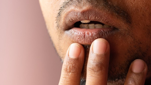 Homme aux lèvres sèches et gercées